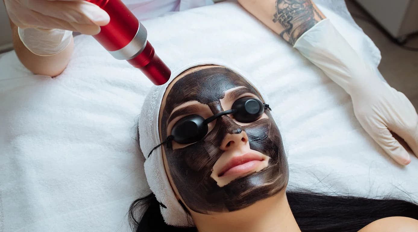 Carbon peeling vs. laser pigmentation removal: which is right for your skin tone?
