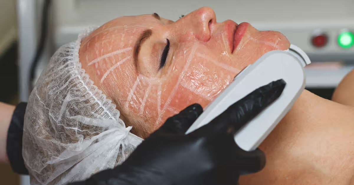 HIFU vs. surgical face lift: a medical perspective